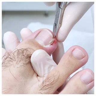 Derma Ped gallery image